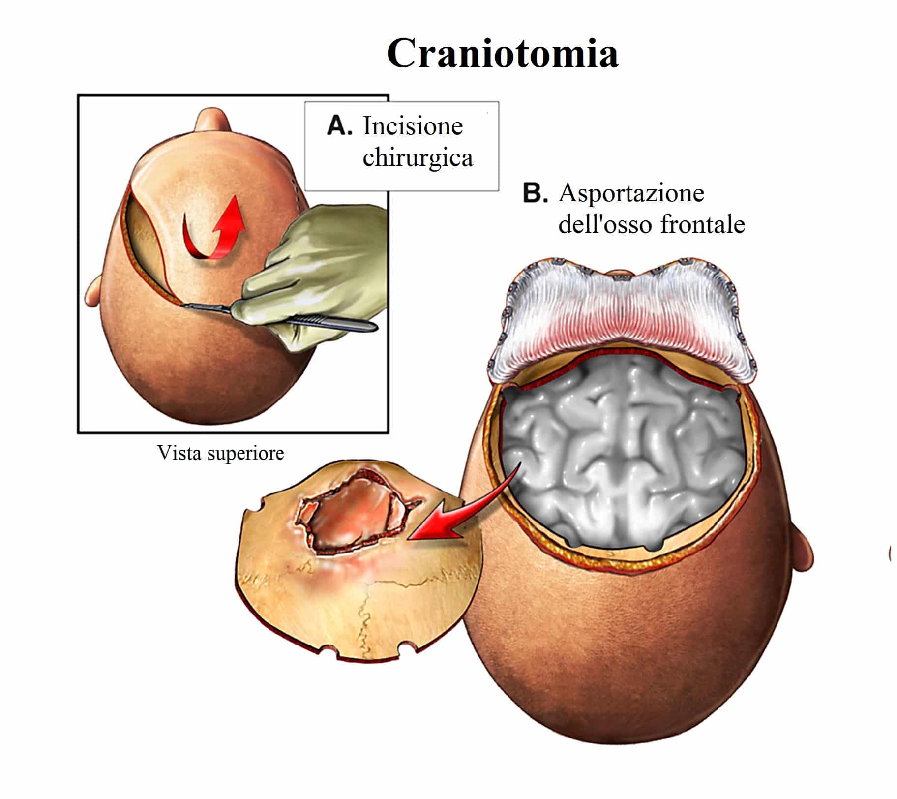 Nevralgia Del Trigemino Sintomi Diagnosi Terapia Farmaci E Rimedi 4415