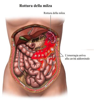 Dolori Al Fegato E Diarrhea Diet